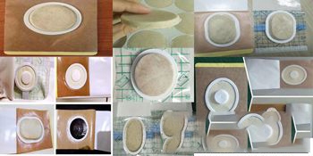 ���պ���ҽ����е���޹�˾-ҽ�������ɳ����͸Ƥ��