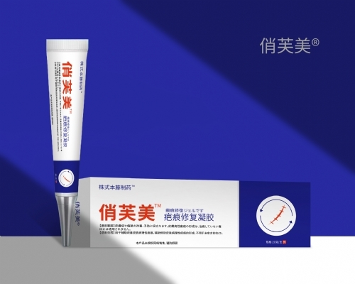 ����ܽ�� ���̺��޸�����